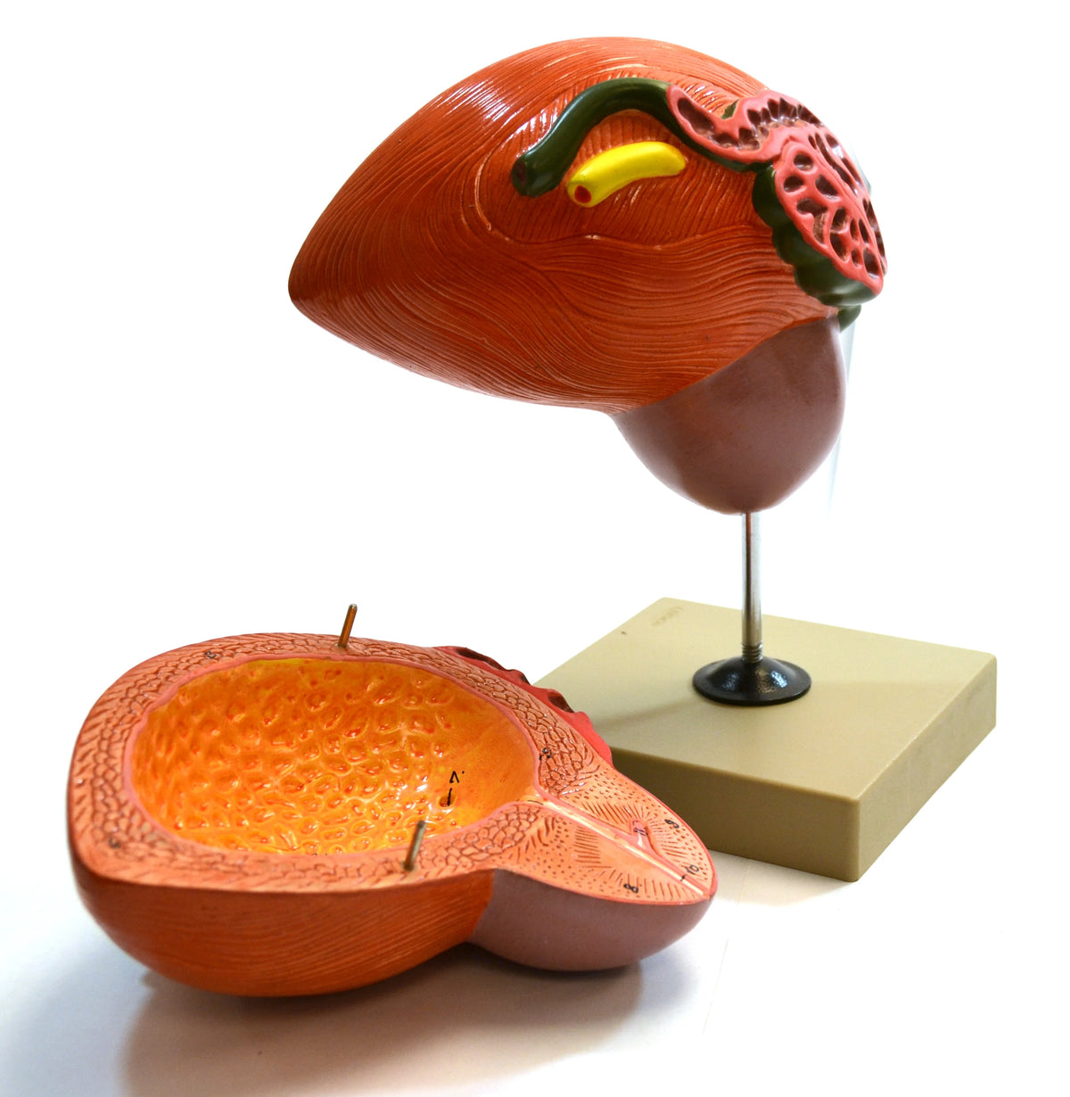 Human Urinary Bladder with Prostate Anatomical Model, 2 Parts, 3 Times Life Size R616