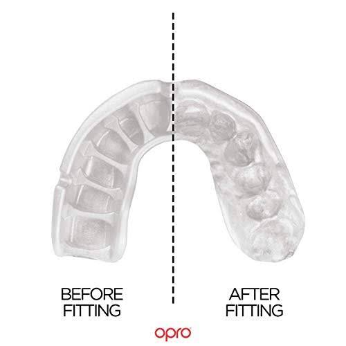 Mouthguard with Case for Boxing, Basketball, LaCrosse, Football, MMA Q7913